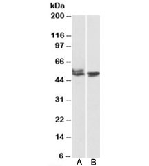 Western blot of mouse (A) and rat (B) testis lysates with MON1A antibody at 1ug/ml. Predicted molecular weight: ~55kDa.