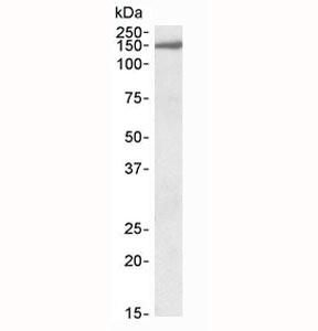 Western blot testing of human brain (cerebellum) lysate with EPB41L3 antibody at 0.3ug/ml. Predicted molecular weight: ~121 kDa, observed here at ~150 kDa.