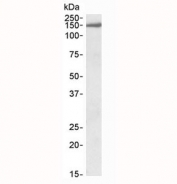 Western blot testing of human brain (cerebellum) lysate with EPB41L3 antibody at 0.3ug/ml. Predicted molecular weight: ~121 kDa, observed here at ~150 kDa.