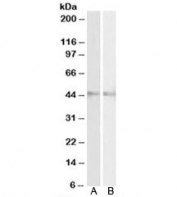 Western blot testing of mouse [A] and rat [B] eye lysates with RNF13 antibody at 2ug/ml. Predicted molecular weight: ~43kDa.
