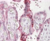 IHC testing of FFPE human placenta with UBE2F antibody at 2.5ug/ml shows membrane staining in trophoblasts.