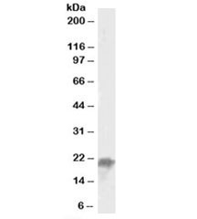 Western blot testing of mouse liver lysate with UBE2F antibody at 0.05ug/ml. Predicted molecular weight: ~21kDa.~