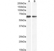 Western blot testing of human A) K562 and B) U937 cell lysate with CD80 antibody. Expected molecular weight: 34-75 kDa depending on the level of glycosylation.