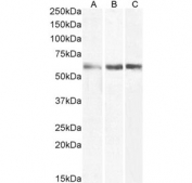 Western blot testing of human A) lymph node, B) bone marrow and C) spleen tissue lysate with CD80 antibody. Expected molecular weight: 34-75 kDa depending on the level of glycosylation.