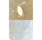 IHC staining of FFPE human spleen tissue with CD80 antibody at 6ug/ml (top) and without primary antibody (bottom). Required HIER: steamed antigen retrieval with pH6 citrate buffer; HRP-staining.