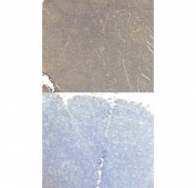 IHC staining of FFPE human tonsil tissue with CD80 antibody at 5ug/ml (top) and without primary antibody (bottom). Required HIER: steamed antigen retrieval with pH6 citrate buffer; HRP-staining.