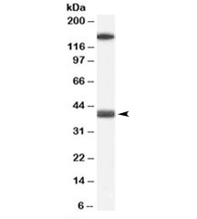 Western blot testing of human heart lysate with GALR1 antibody at 0.1ug/ml. The expected ~40kDa band and the additional ~150kDa band are both blocked by the immunizing peptide.
