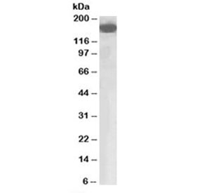 Western blot testing of human lung lysate with CFH antibody at 0.03ug/ml. Predicted molecular weight: ~139kDa, observed here at ~170kDa.~
