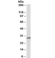 Western blot testing of human spleen lysate with Proteinase 3 antibody at 2ug/ml. Predicted molecular weight ~28kDa.~