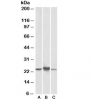Western blot testing of human [A], mouse [B], rat [C] liver lysate with ABHD14B antibody at 0.3ug/ml. Predicted molecular weight: ~22kDa.