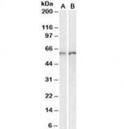 Western blot testing of human [A] and rat [B] lung lysates with Calreticulin antibody at 0.01ug/ml. Predicted molecular weight ~48kDa but routinely observed at 55~60kDa.