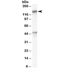 Western blot testing of human brain lysate with Patched antibody at 1ug/ml. Predicted molecular weight ~161/154/144kDa (isoforms L/M/S) with glycosylated PTCH1 visualized at ~200kDa.