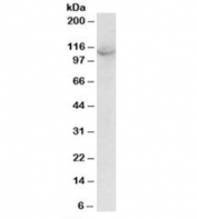 Western blot testing of A431 lysate with OAS3 antibody at 2ug/ml. Predicted molecular weight: ~121kDa, observed here at ~110kDa.