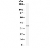 Western blot testing of rat spleen lysate with OGG1 antibody at 0.1ug/ml. Predicted molecular weight ~38 kDa.