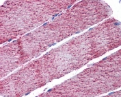 IHC testing of FFPE human skeletal muscle tissue with FH antibody at 3.75ug/ml. Required HIER: steamed antigen retrieval with pH6 citrate buffer; AP-staining.