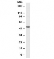 Western blot testing of human kidney lysate with biotinylated FH antibody at 0.1ug/ml. Predicted molecular weight: ~55/50kDa (isoforms 1/2).