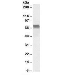 Western blot testing of Daudi lysate with LMO6 antibody at 0.1ug/ml. Predicted molecular weight: ~69kDa.