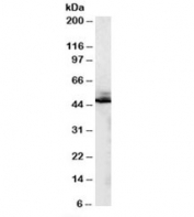 Western blot testing of human liver lysate with beta-2-Adrenergic receptor antibody at 0.2ug/ml. Predicted molecular weight ~46 kDa, but commonly observed at up to 85 kDa.