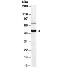 Western blot testing of human brain lysate with FOXG1 antibody at 0.3ug/ml. Predicted molecular weight ~50/52kDa (FOXG1A/FOXG1B). Both observed bands are blocked by the immunizing peptide.