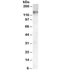 Western blot testing of A549 lysate with ABCC1 antibody at 0.05ug/ml. Predicted molecular weight: ~159kDa.