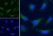 IF/ICC staining of human HeLa cells with Alexa Fluor 488 secondary, and GAPDH antibody at 5ug/ml (blue = DAPI nuclear counterstain).