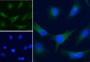 IF/ICC staining of fixed and permeabilized human HeLa cells with Alexa Fluor 488 secondary, and GAPDH antibody at 5ug/ml (blue = DAPI nuclear counterstain).
