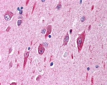 IHC testing of FFPE human cerebellar cortex with PI3K antibody at 2.5ug/ml. HIER: steamed with pH6 citrate buffer, AP-staining.~