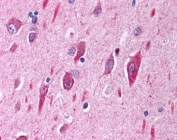 IHC testing of FFPE human cerebellar cortex with PI3K antibody at 2.5ug/ml. HIER: steamed with pH6 citrate buffer, AP-staining.