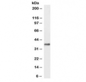 Western blot testing of human liver lysate with DARC antibody at 0.3ug/ml. Predicted molecular weight: ~36 kDa.