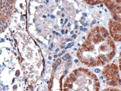 IHC staining of FFPE human kidney with DARC antibody at 3ug/ml. HIER: microwaved with pH6 citrate buffer, HRP-staining.