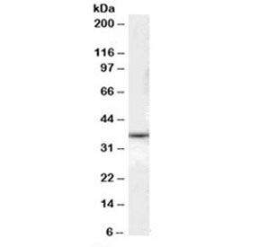 Western blot testing of human liver lysate with DARC antibody at 0.1ug/ml. Predicted molecular weight: ~36kDa.