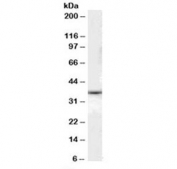 Western blot testing of human liver lysate with DARC antibody at 0.1ug/ml. Predicted molecular weight: ~36 kDa.