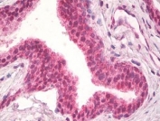 IHC testing of FFPE human prostate tissue with NPR3 antibody at 10ug/ml. Required HIER: steamed antigen retrieval with pH6 citrate buffer; AP-staining.