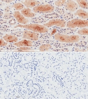 IHC testing of FFPE human kidney tissue with (top) and without (bottom) NPR3 antibody at 2ug/ml. HIER: steam section in pH6 citrate buffer for 20 min.