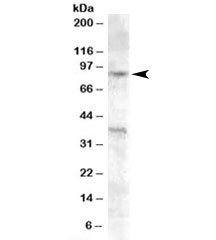 Western blot testing of A549 cell lysate with EXO1 antibody at 0.2ug/ml. The expected ~90kDa band and the additional ~38kDa band are both blocked by the immunizing peptide.