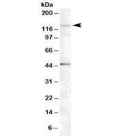Western blot testing of Jurkat lysate with Tankyrase 2 antibody at 0.5ug/ml. The expected ~125kDa band and the additional ~45kDa band are both blocked by the immunizing peptide.