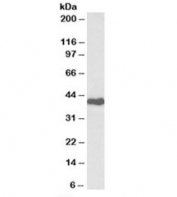 Western blot testing of Jurkat lysate with CDK7 antibody at 0.3ug/ml. Predicted molecular weight: ~37kDa.