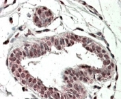 IHC testing of FFPE human breast with TREX2 antibody at 4ug/ml. HIER: steamed with pH6 citrate buffer, AP-staining.