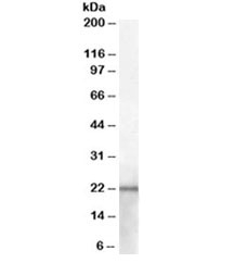 Western blot testing of mouse kidney lysate with NGAL antibody at 2ug/ml. Predicted molecular weight ~22kDa.