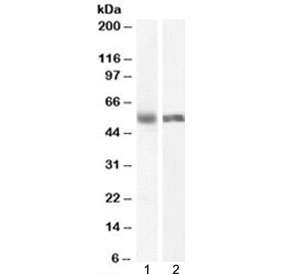 Western blot testing of human 1) liver and 2) lung lysate with Cyp1a2 antibody at 0.5ug/ml. Predicted molecular weight