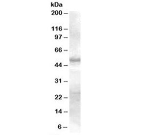 Western blot testing of human skin lysate with SMAD9 antibody at 0.3ug/ml. Predicted molecular weight: ~49kDa.