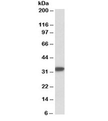 Western blot testing of human tonsil lysate with CD74 antibody at 0.03ug/ml. Predicted molecular weight ~33kDa.