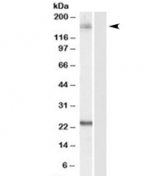 Western blot testing of HeLa lysate with GOLGA3 antibody at 0.1ug/ml. Predicted/observed molecular weight 160~170kDa.