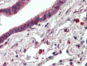 IHC testing of FFPE human lung tissue with HER3 antibody at 5ug/ml. Steamed antigen retrieval with citrate buffer pH 6, AP-staining.