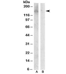 Western blot testing of Jurkat lysate with HER3 antibody at 0.1ug/ml with [B] and without [A] immunizing peptide. Predicted molecular weight ~148kDa.~