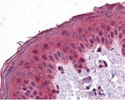 IHC testing of FFPE human skin tissue with SAR1 antibody at 3.75ug/ml. Required HIER: steamed antigen retrieval with pH6 citrate buffer; AP-staining.