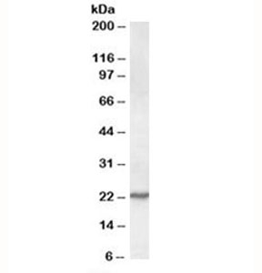 Western blot testing of NIH3T3 lysate with SAR1 antibody at 0.1ug/ml. Predicted molecular weight: ~22kDa.