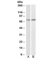 Western blot testing of HepG2 [A] and K562 [B] lysates with CYP2B6 antibody at 0.1ug/ml. Predicted molecular weight: ~56kDa, observed here at ~75kDa.