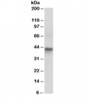 Western blot testing of human colon cancer lysate with Cytokeratin 19 antibody at 0.03ug/ml. Predicted/observed molecular weight ~43/40-43kDa.