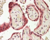 IHC staining of FFPE human placenta with TRC8 antibody at 4ug/ml. HIER: steamed with pH6 citrate buffer, AP-staining.